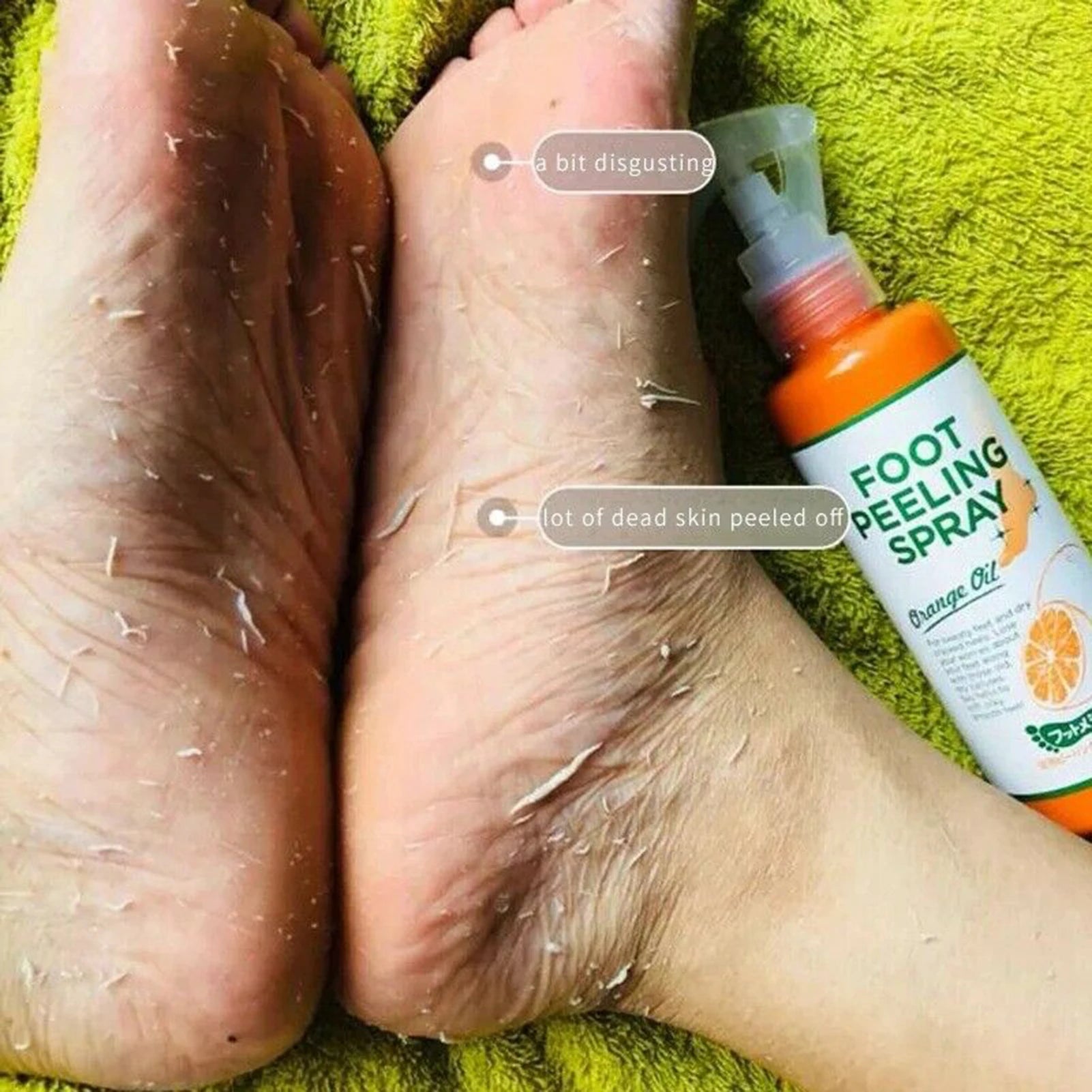 Foot Peeling Spray Improves Texture and Rough Skin